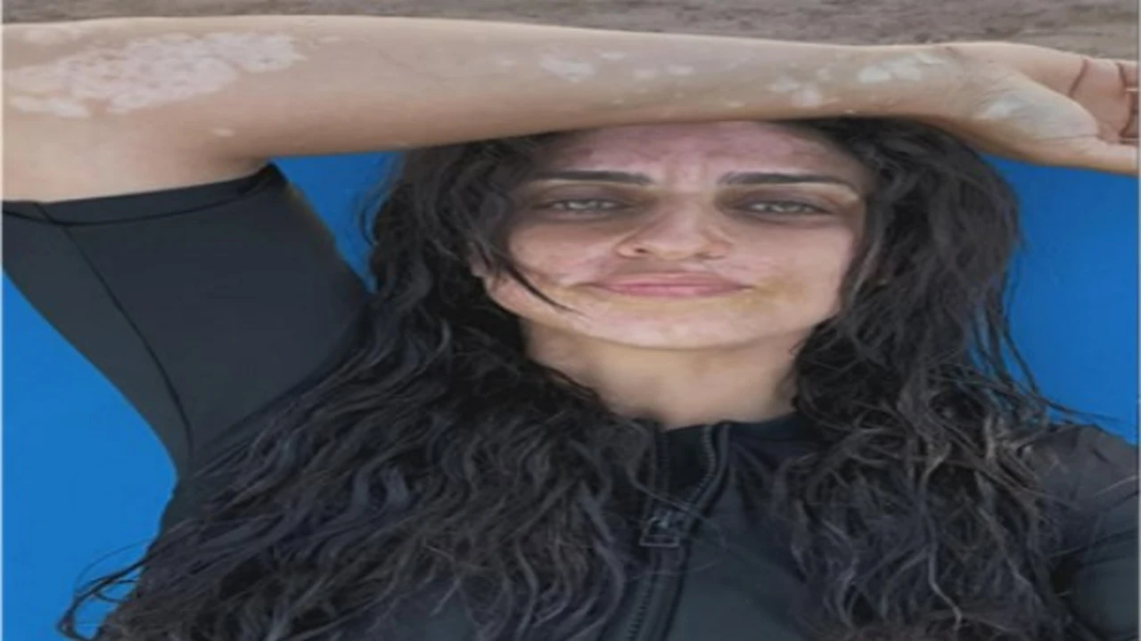 تعليق مثير.. أمير كرارة يثير الجدل بعد إصابة شقيقته بالبهاق